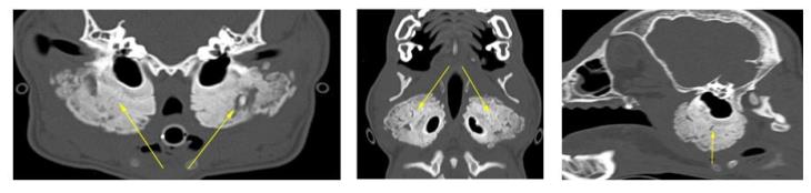 CT scan was performed