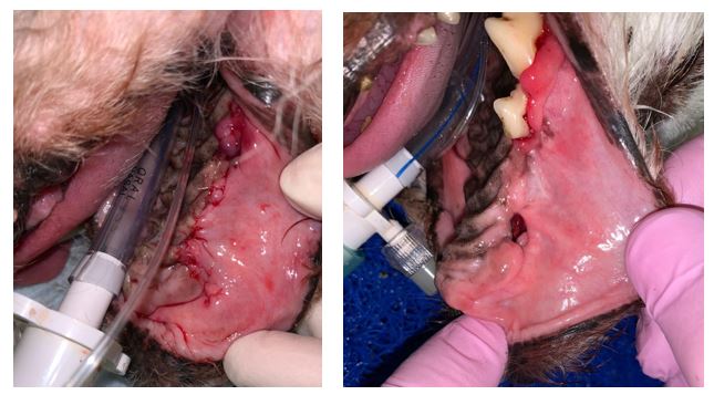 An oro-nasal fistula