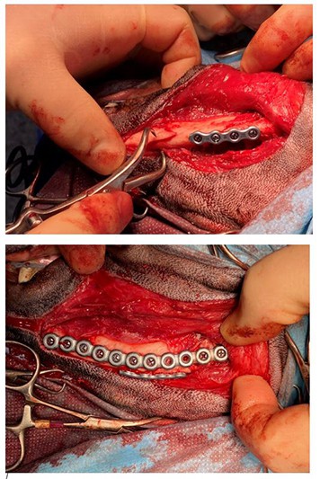 Using titanium mini-plates