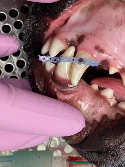 temporary elastic maxillomandibular fixation