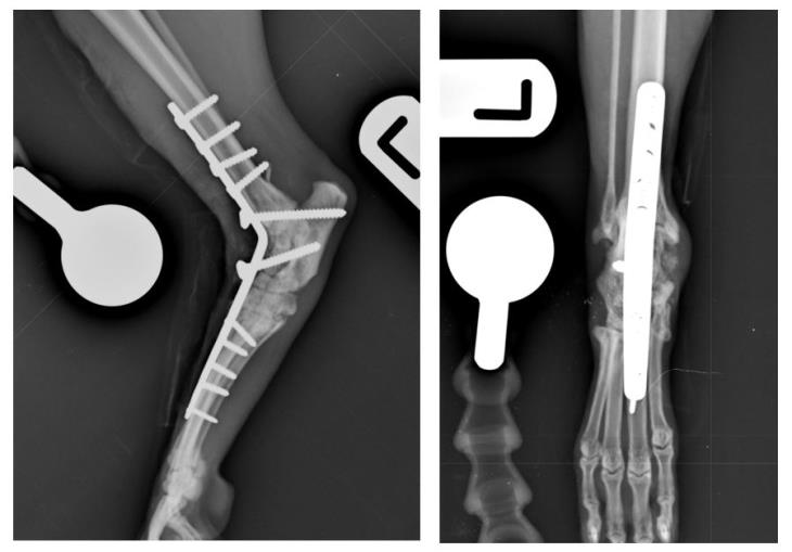 postoperative view of this patient’s left tarsus