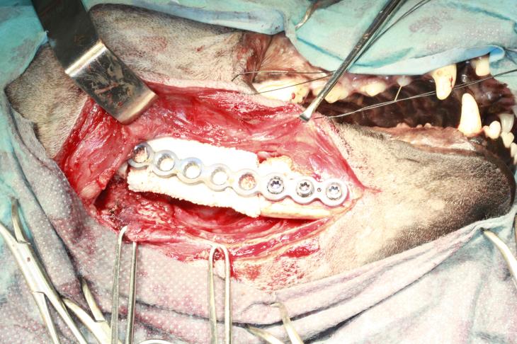 placement of rh-BMP infused CRM_