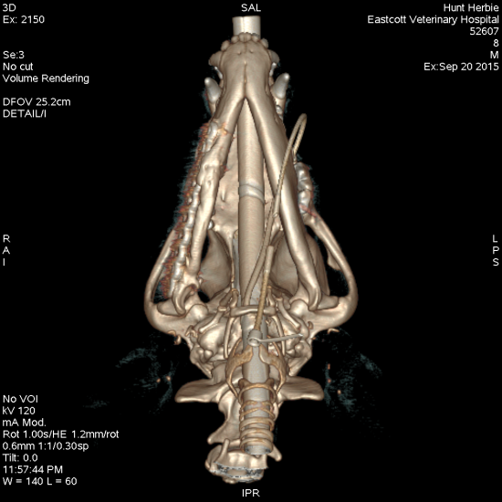 three dimensional reconstruction CT