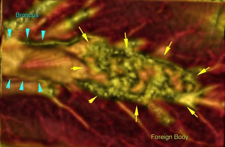 3D reconstruction of the lumen of main R caudal bronchus