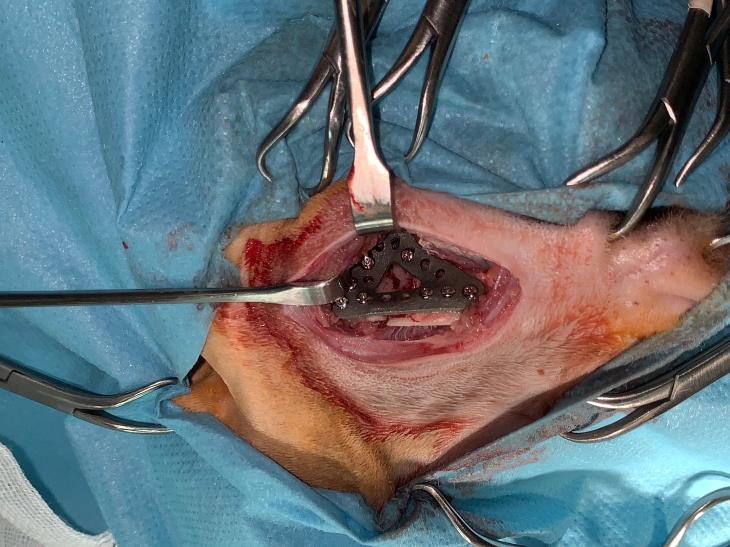 Surgical approach to application of 3d implant
