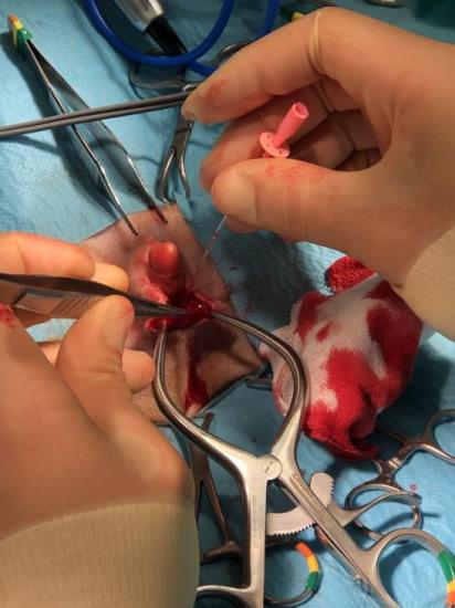 Catheterisation of urethra