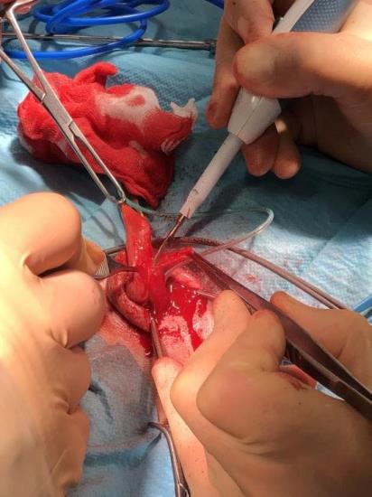 pseudophallus dissected free