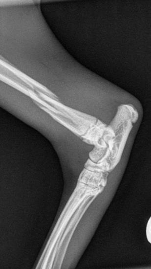 lateral tarsus xray