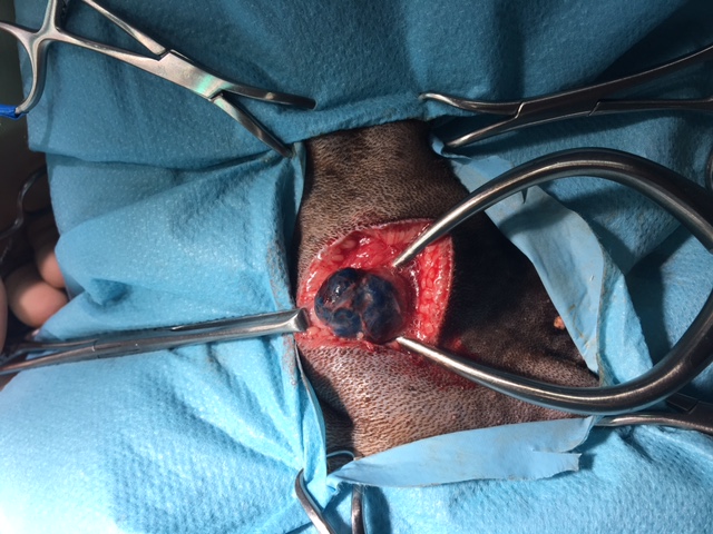 SLN stained blue allowing easy identification