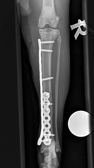 Tibia Cranio Caudal Xray
