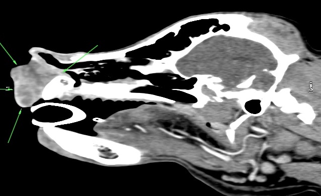 SLN stained blue allowing easy identification
