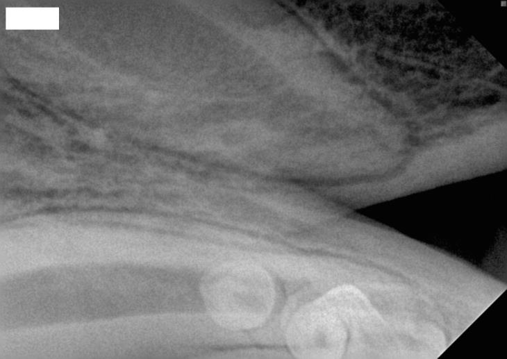 Development of tooth