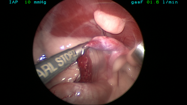 Both gonads were grossly consistent with testes