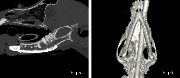 CT Scans of 3D printed titanium patient specific implant