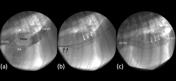 ct scan of dogs heart after life saving surgery - fluroscopy