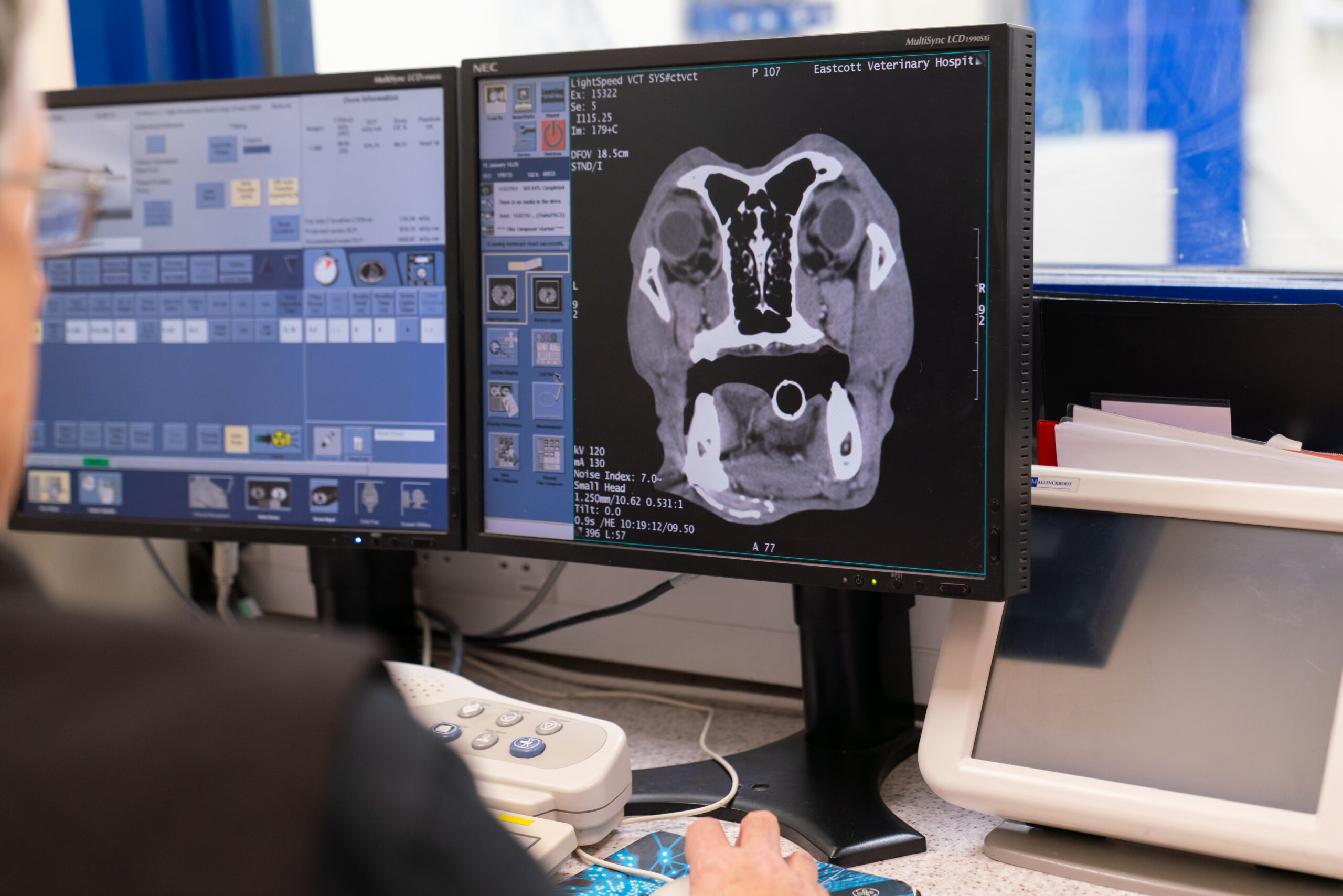 MRI scan on a screen