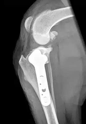 xray image