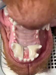 An inclined plane guiding the lower canine teeth into a non-traumatic position