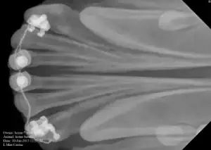 An X-ray showing that the same teeth have been replaced
