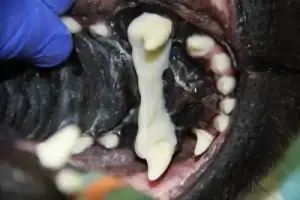 The dog's tooth, repositioned with a lightweight splint stabilising it