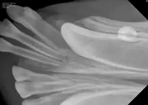 An x-ray showing three displaced incisors